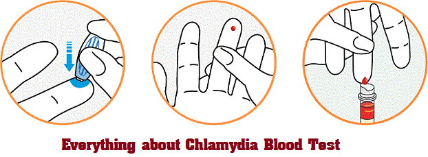 chlamydia blood test accuracy and result
