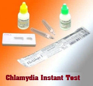 chlamydia instant test result and kit