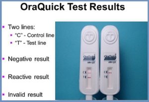 OraQuick Reviews - HIV Test Kit Price