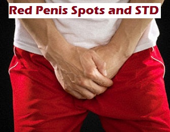 red penis spots and std symptoms